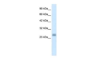 Western Blot: HES7 Antibody [NBP2-85042] - WB Suggested Anti-HES7 Antibody Titration: 0.2-1 ug/ml. ELISA Titer: 1:312500. Positive Control: Human heart