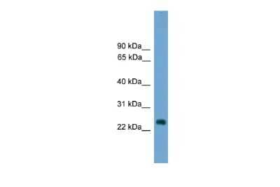 Western Blot: HES7 Antibody [NBP2-85044] - WB Suggested Anti-Hes7 Antibody Titration: 0.2-1 ug/ml. ELISA Titer: 1:312500. Positive Control: NIH/3T3 cell lysate