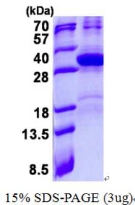 SDS-Page: HES7 Protein [NBP2-23100]