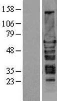 Western Blot: HEXIM1 Overexpression Lysate (Adult Normal) [NBL1-11518] Left-Empty vector transfected control cell lysate (HEK293 cell lysate); Right -Over-expression Lysate for HEXIM1.