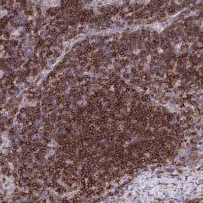 Immunohistochemistry: HEXO Antibody [NBP2-38782] - Staining of human lymph node shows strong cytoplasmic positivity in non-germinal center cells.