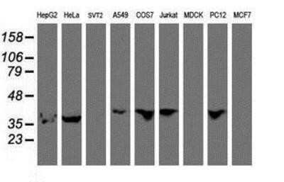 Flow Cytometry: HEXO Antibody (OTI1B3) - Azide and BSA Free [NBP2-72312] - Analysis of extracts (35ug) from 9 different cell lines by using anti-HEXO monoclonal antibody.