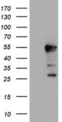 Western Blot: HEXO Antibody (OTI1B3) - Azide and BSA Free [NBP2-72312] - HEK293T cells were transfected with the pCMV6-ENTRY control (Left lane) or pCMV6-ENTRY HEXO (Right lane) cDNA for 48 hrs and lysed. Equivalent amounts of cell lysates (5 ug per lane) were separated by SDS-PAGE and immunoblotted with anti-HEXO.