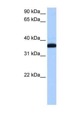 Western Blot: HEXO Antibody [NBP1-57118] - MCF-7 whole cell lysates, concentration 0.2-1 ug/ml.