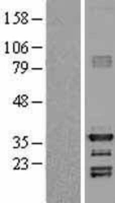 Western Blot: HEY1 Overexpression Lysate (Adult Normal) [NBL1-11520] Left-Empty vector transfected control cell lysate (HEK293 cell lysate); Right -Over-expression Lysate for HEY1.