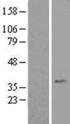 Western Blot: HEY1 Overexpression Lysate (Adult Normal) [NBL1-11521] Left-Empty vector transfected control cell lysate (HEK293 cell lysate); Right -Over-expression Lysate for HEY1.