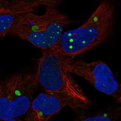 Immunocytochemistry/Immunofluorescence: HEY2 Antibody [NBP2-57809] - Staining of human cell line HEK 293 shows localization to nuclear bodies & aggresome.