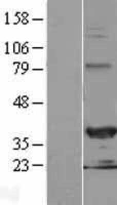 Western Blot: HEY2 Overexpression Lysate (Adult Normal) [NBL1-11522] Left-Empty vector transfected control cell lysate (HEK293 cell lysate); Right -Over-expression Lysate for HEY2.