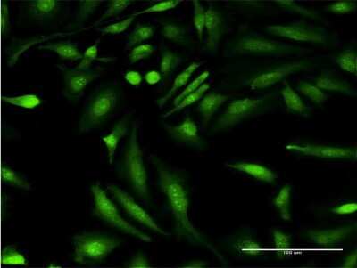 Immunocytochemistry/Immunofluorescence: HGD Antibody (3G4) [H00003081-M10] - Analysis of monoclonal antibody to HGD on HeLa cell. Antibody concentration 10 ug/ml