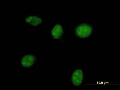 Immunocytochemistry/Immunofluorescence: HGD Antibody [H00003081-B01P] - Analysis of purified antibody to HGD on HeLa cell. (antibody concentration 10 ug/ml)