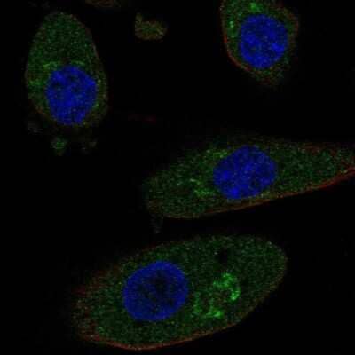 Immunocytochemistry/Immunofluorescence: HGD Antibody [NBP2-49039] - Staining of human cell line RPTEC TERT1 shows localization to the Golgi apparatus. Antibody staining is shown in green.