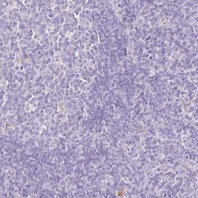 Immunohistochemistry-Paraffin: HGD Antibody [NBP2-33488] - Staining of human tonsil shows low expression as expected.