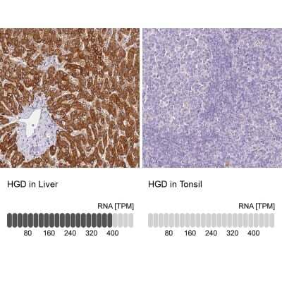 <b>Orthogonal Strategies Validation. </b>Immunohistochemistry-Paraffin: HGD Antibody [NBP2-33488] - Staining in human liver and tonsil tissues using anti-HGD antibody. Corresponding HGD RNA-seq data are presented for the same tissues.