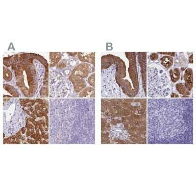 <b>Independent Antibodies Validation. </b>Immunohistochemistry-Paraffin: HGD Antibody [NBP2-33488] - Staining of human gallbladder, kidney, liver and tonsil using Anti-HGD antibody NBP2-33488 (A) shows similar protein distribution across tissues to independent antibody NBP2-49039 (B).