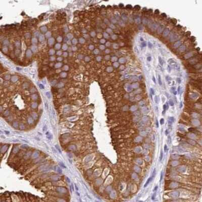 Immunohistochemistry-Paraffin: HGD Antibody [NBP2-33488] - Staining of human gallbladder.