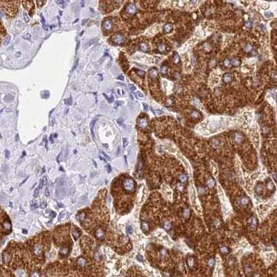 Immunohistochemistry-Paraffin: HGD Antibody [NBP2-33488] - Staining of human liver using Anti-HGD antibody NBP2-33488.