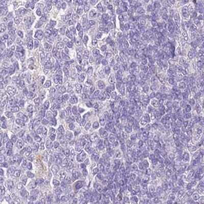 <b>Independent Antibodies Validation. </b>Immunohistochemistry-Paraffin: HGD Antibody [NBP2-33488] - Staining of human tonsil using Anti-HGD antibody NBP2-33488.