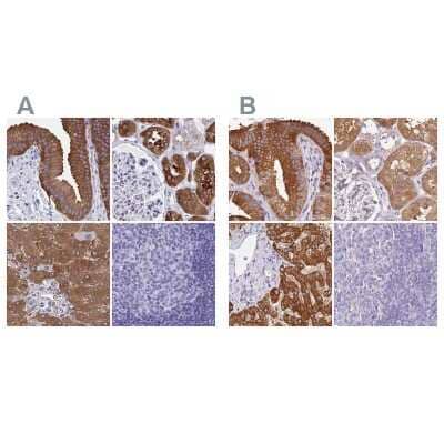 Immunohistochemistry-Paraffin: HGD Antibody [NBP2-49039] - Staining of human gallbladder, kidney, liver and tonsil using Anti-HGD antibody NBP2-49039 (A) shows similar protein distribution across tissues to independent antibody NBP2-33488 (B).