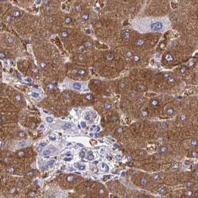 Immunohistochemistry-Paraffin: HGD Antibody [NBP2-49039] - Staining of human liver using Anti-HGD antibody NBP2-49039.