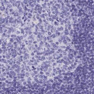 Immunohistochemistry-Paraffin: HGD Antibody [NBP2-49039] - Staining of human tonsil using Anti-HGD antibody NBP2-49039.