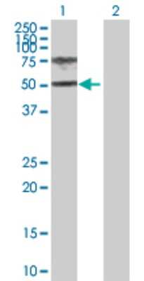 Western Blot: HGD Antibody [H00003081-D01P] - Analysis of HGD expression in transfected 293T cell line by HGD polyclonal antibody.Lane 1: HGD transfected lysate(50.00 KDa).Lane 2: Non-transfected lysate.