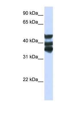 Western Blot: HGD Antibody [NBP1-55134] - Titration: 0.2-1 ug/ml, Positive Control: Hela cell lysate.