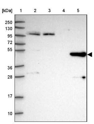 Western Blot: HGD Antibody [NBP2-33488] - Lane 1: Marker [kDa] 250, 130, 95, 72, 55, 36, 28, 17, 10Lane 2: Human cell line RT-4Lane 3: Human cell line U-251MG spLane 4: Human plasma (IgG/HSA depleted)Lane 5: Human liver tissue