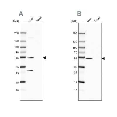 Western Blot: HGD Antibody [NBP2-33488] - Analysis using Anti-HGD antibody NBP2-33488 (A) shows similar pattern to independent antibody NBP2-49039 (B).