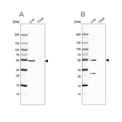 Western Blot: HGD Antibody [NBP2-49039] - Analysis using Anti-HGD antibody NBP2-49039 (A) shows similar pattern to independent antibody NBP2-33488 (B).