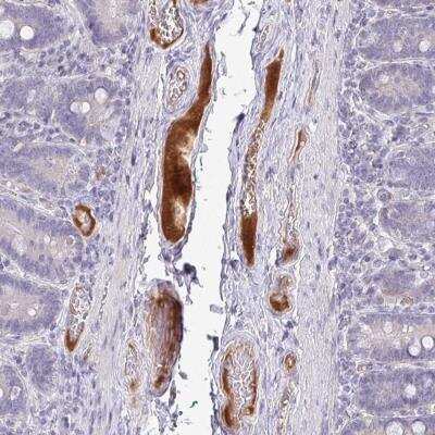 Immunohistochemistry-Paraffin: HGF Activator Antibody [NBP2-31710] - HGFAC Antibody [NBP2-31710] - Staining of human duodenum shows distinct positivity in plasma.