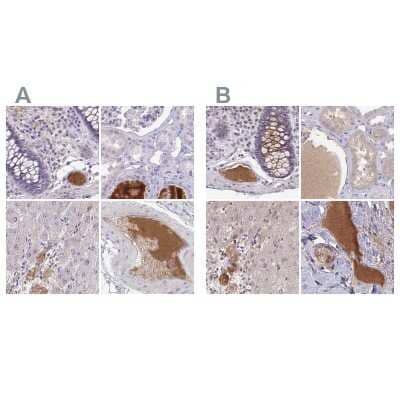 <b>Independent Antibodies Validation. </b>Immunohistochemistry-Paraffin: HGF Activator Antibody [NBP2-31710] - Staining of human colon, kidney, liver and soft tissues using Anti-HGFAC antibody NBP2-31710 (A) shows similar protein distribution across tissues to independent antibody NBP2-31741 (B).