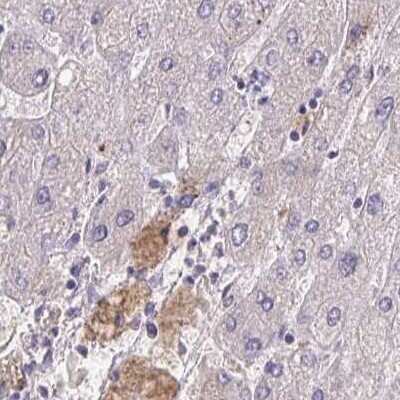 Immunohistochemistry-Paraffin: HGF Activator Antibody [NBP2-31710] - Staining of human liver.