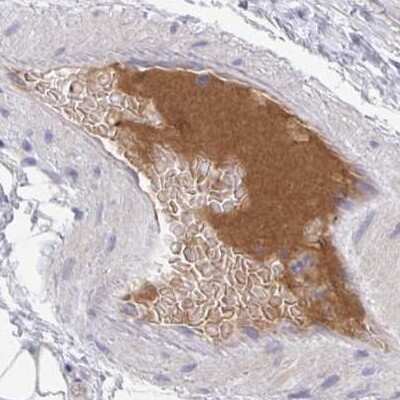 Immunohistochemistry-Paraffin: HGF Activator Antibody [NBP2-31710] - Staining of human soft tissues.