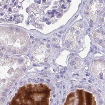 Immunohistochemistry-Paraffin: HGF Activator Antibody [NBP2-31710] - Staining of human kidney.