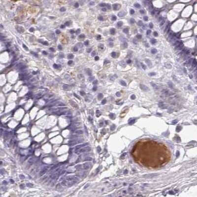 Immunohistochemistry-Paraffin: HGF Activator Antibody [NBP2-31710] - Staining of human colon.