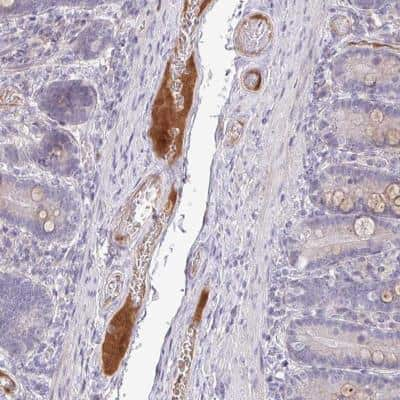 Immunohistochemistry-Paraffin: HGF Activator Antibody [NBP2-31741] - HGFAC Antibody [NBP2-31741] - Staining of human duodenum shows distinct positivity in plasma.