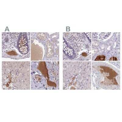 <b>Independent Antibodies Validation. </b>Immunohistochemistry-Paraffin: HGF Activator Antibody [NBP2-31741] - Staining of human colon, kidney, liver and soft tissues using Anti-HGFAC antibody NBP2-31741 (A) shows similar protein distribution across tissues to independent antibody NBP2-31710 (B).