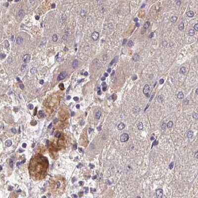 Immunohistochemistry-Paraffin: HGF Activator Antibody [NBP2-31741] - Staining of human liver.