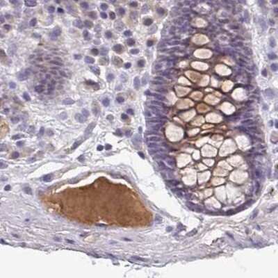 Immunohistochemistry-Paraffin: HGF Activator Antibody [NBP2-31741] - Staining of human colon.