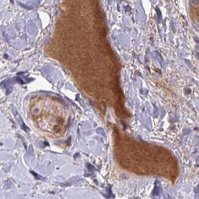 Immunohistochemistry-Paraffin: HGF Activator Antibody [NBP2-31741] - Staining of human soft tissues.