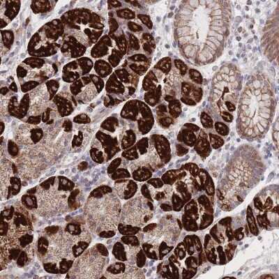 Immunohistochemistry: HGF Antibody [NBP2-48806] - Staining of human stomach, lower shows strong cytoplasmic positivity in glandular cells.