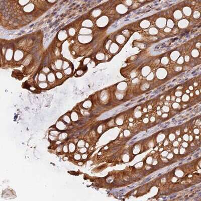 Immunohistochemistry-Paraffin: HGF Antibody [NBP2-48724] - Staining of human rectum shows strong cytoplasmic and membranous positivity in glandular cells.