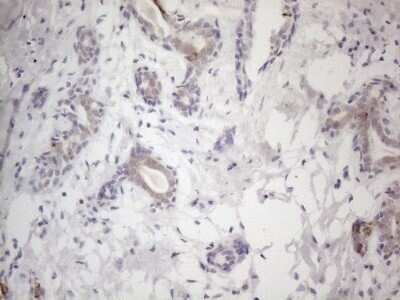 Immunohistochemistry: HGF Antibody (OTI1D2) - Azide and BSA Free [NBP2-70884] - Analysis of Human breast tissue. (Heat-induced epitope retrieval by 1mM EDTA in 10mM Tris buffer (pH8.5) at 120°C for 3 min)