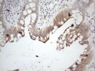 Immunohistochemistry: HGF Antibody (OTI1D2) - Azide and BSA Free [NBP2-70884] - Analysis of Human colon tissue. (Heat-induced epitope retrieval by 1mM EDTA in 10mM Tris buffer (pH8.5) at 120C for 3 min)(1:150)