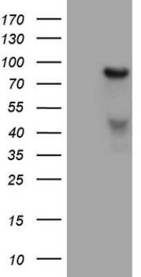 Western Blot: HGF Antibody (OTI1D2) - Azide and BSA Free [NBP2-70884] - Analysis of HEK293T cells were transfected with the pCMV6-ENTRY control (Left lane) or pCMV6-ENTRY HGF.