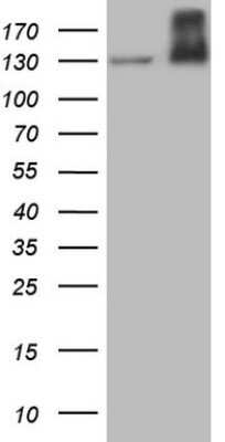 Western Blot: HGFR/c-MET Antibody (OTI1E6) - Azide and BSA Free [NBP2-71196] - Analysis of HEK293T cells were transfected with the pCMV6-ENTRY control (Left lane) or pCMV6-ENTRY c-MET.