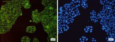 Immunocytochemistry/Immunofluorescence: HGFR/c-MET Antibody (S02-4D6) [NBP3-14873] - Immunofluorescence of HGFR/c-MET (green) in Hela cells using HGFR/c-MET Rabbit mAb at dilution 1/200, and DAPI (blue)