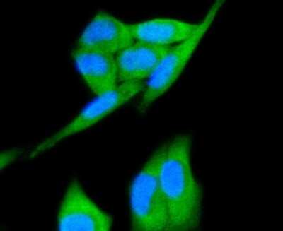 Immunocytochemistry/Immunofluorescence: HGFR/c-MET Antibody (SJ19-05) [NBP2-67412] - Staining Met in Hela cells (green). The nuclear counter stain is DAPI (blue). Cells were fixed in paraformaldehyde, permeabilised with 0.25% Triton X100/PBS.