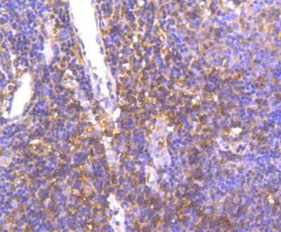 Immunohistochemistry-Paraffin: HGFR/c-MET Antibody (SJ19-05) [NBP2-67412] - Analysis of paraffin-embedded human tonsil tissue using anti-Met antibody. Counter stained with hematoxylin.
