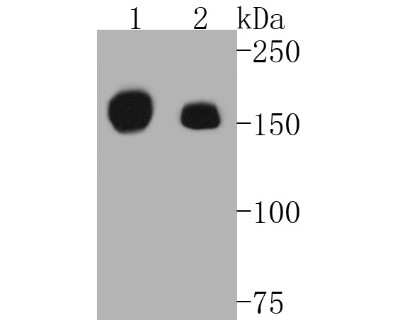 Western Blot: HGFR/c-MET Antibody (SJ19-05) [NBP2-67412] - Western blot analysis of HGFR/c-MET on different lysates. Proteins were transferred to a PVDF membrane and blocked with 5% BSA in PBS for 1 hour at room temperature. The primary antibody (1/500) was used in 5% BSA at room temperature for 2 hours. Goat Ant